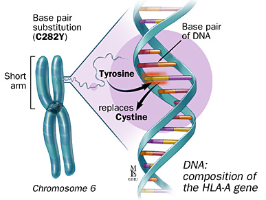 hemochromatosis gene