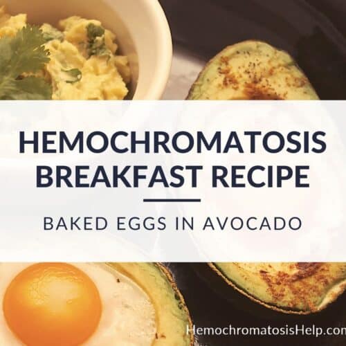 Hemochromatosis Breakfast Recipe Baked Eggs in Avocado