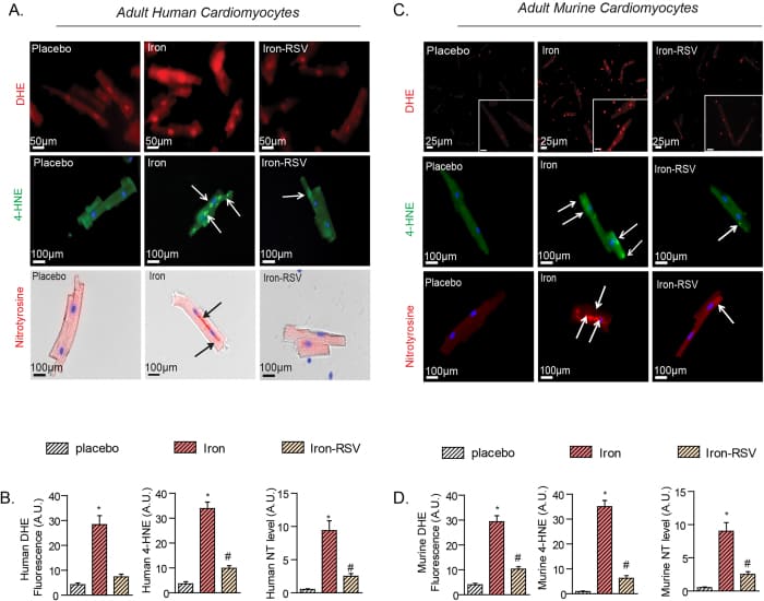 Iron-induced pro-oxidant effects in human and murine cardiomyocytes and in murine models of iron-overload are prevented by RSV.